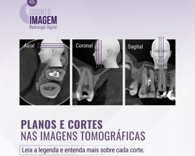 planos-e-cortes-nas-imagens-tomograficas