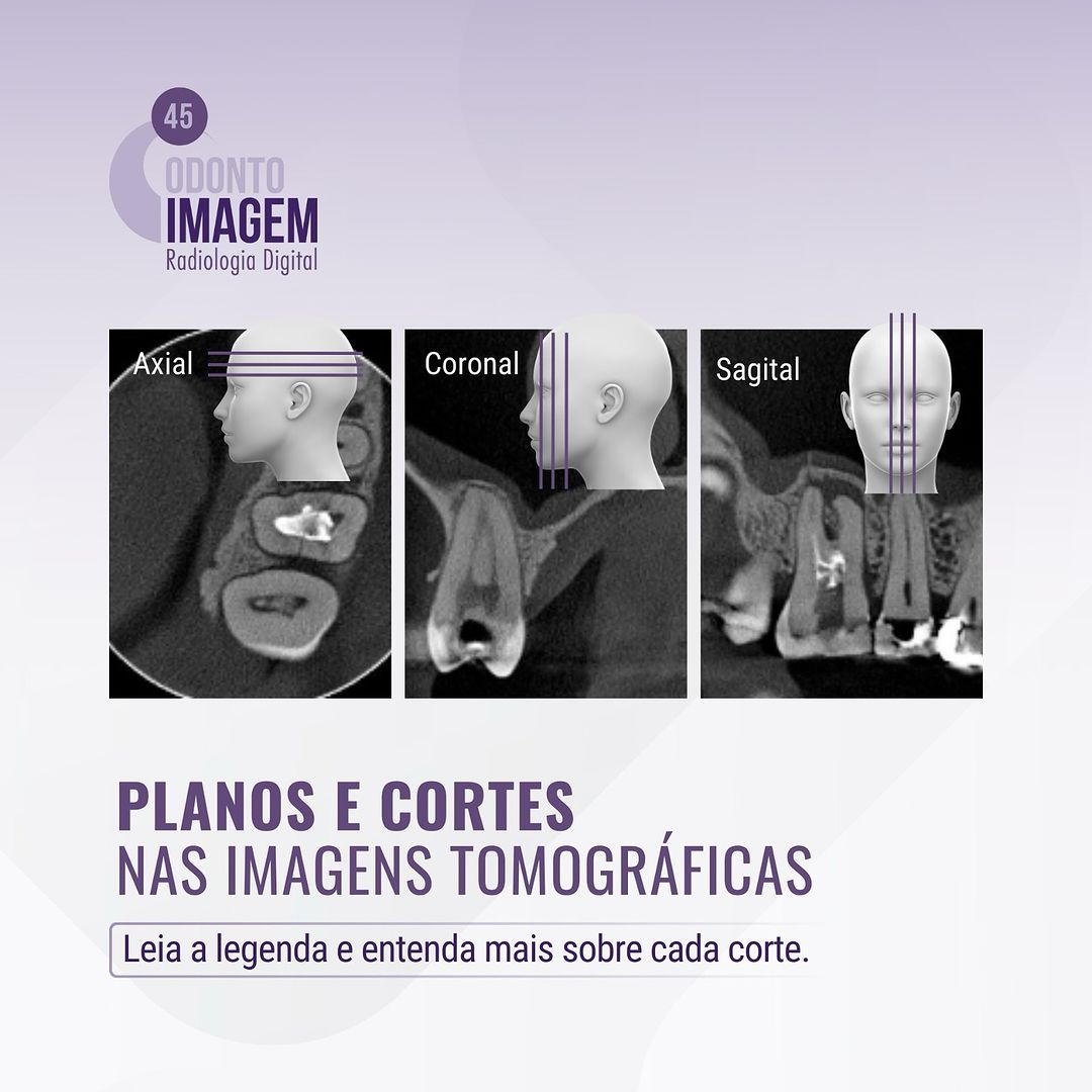 planos-e-cortes-nas-imagens-tomograficas