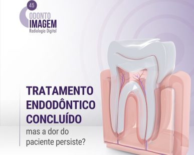 tratamento-endodontico-concluido