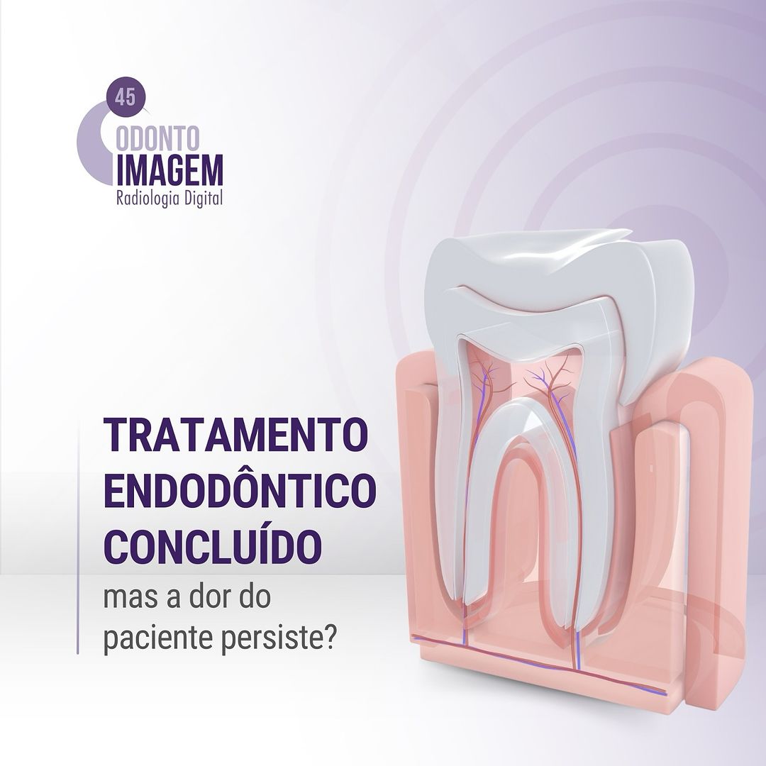 tratamento-endodontico-concluido