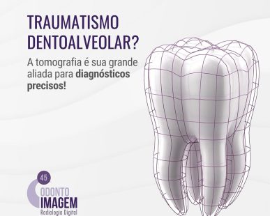 traumatismo-dentoalveolar