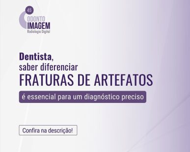 diferenca-entre-fraturas-e-artefatos