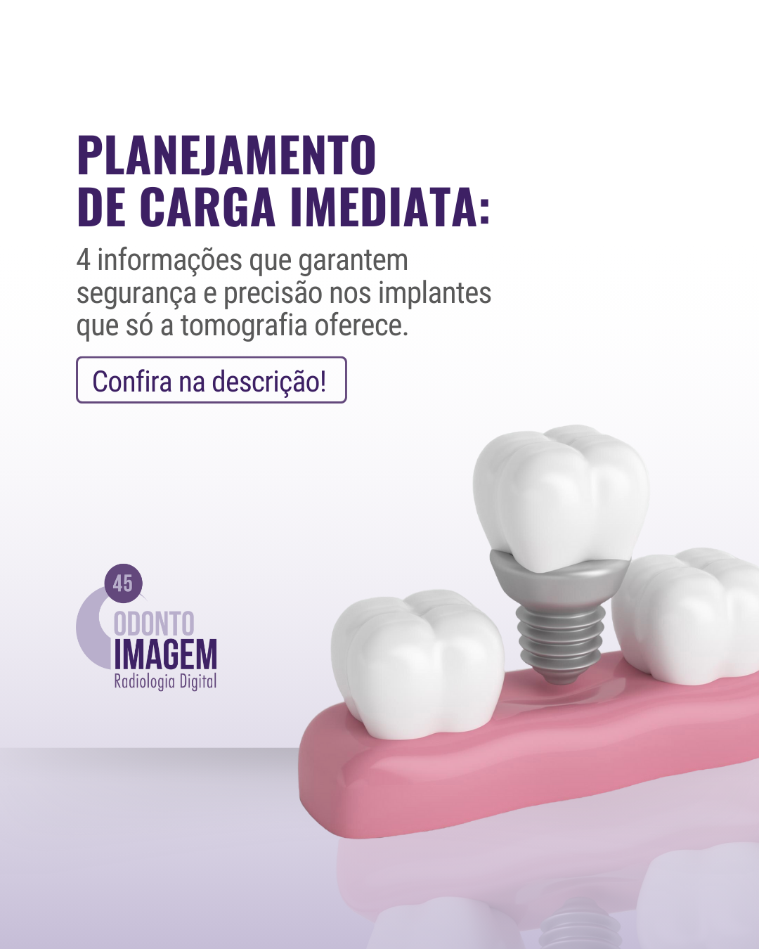 planejamento-de-carga-imediata