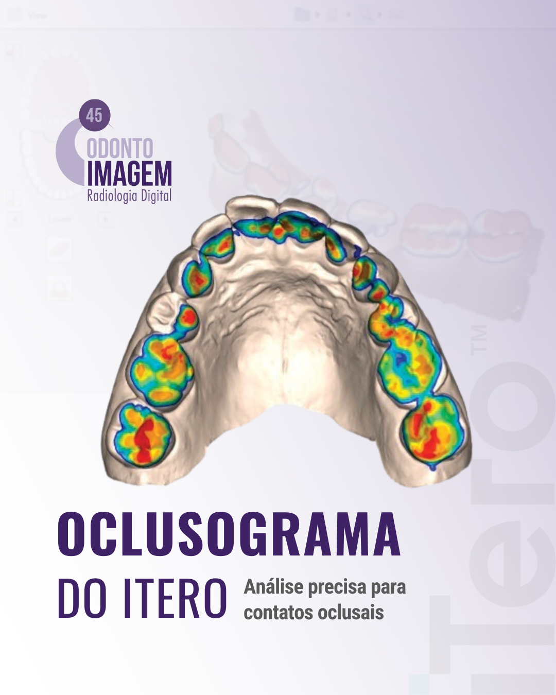 oclusograma-do-itero