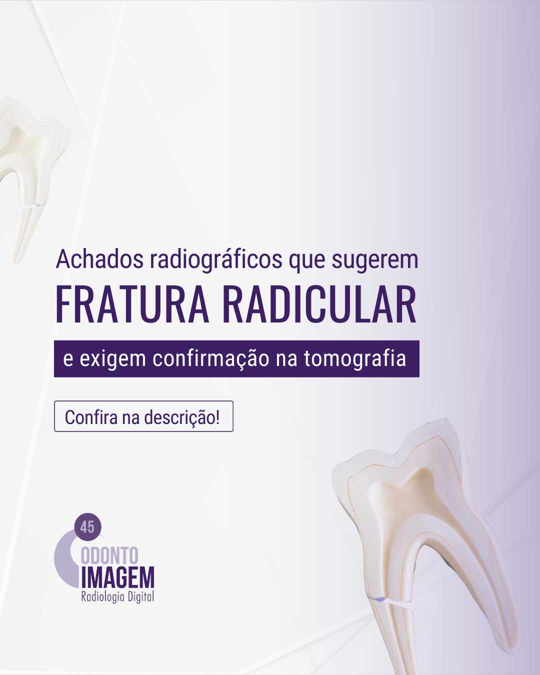 achados-radiograficos-que-sugerem-fratura-radicular