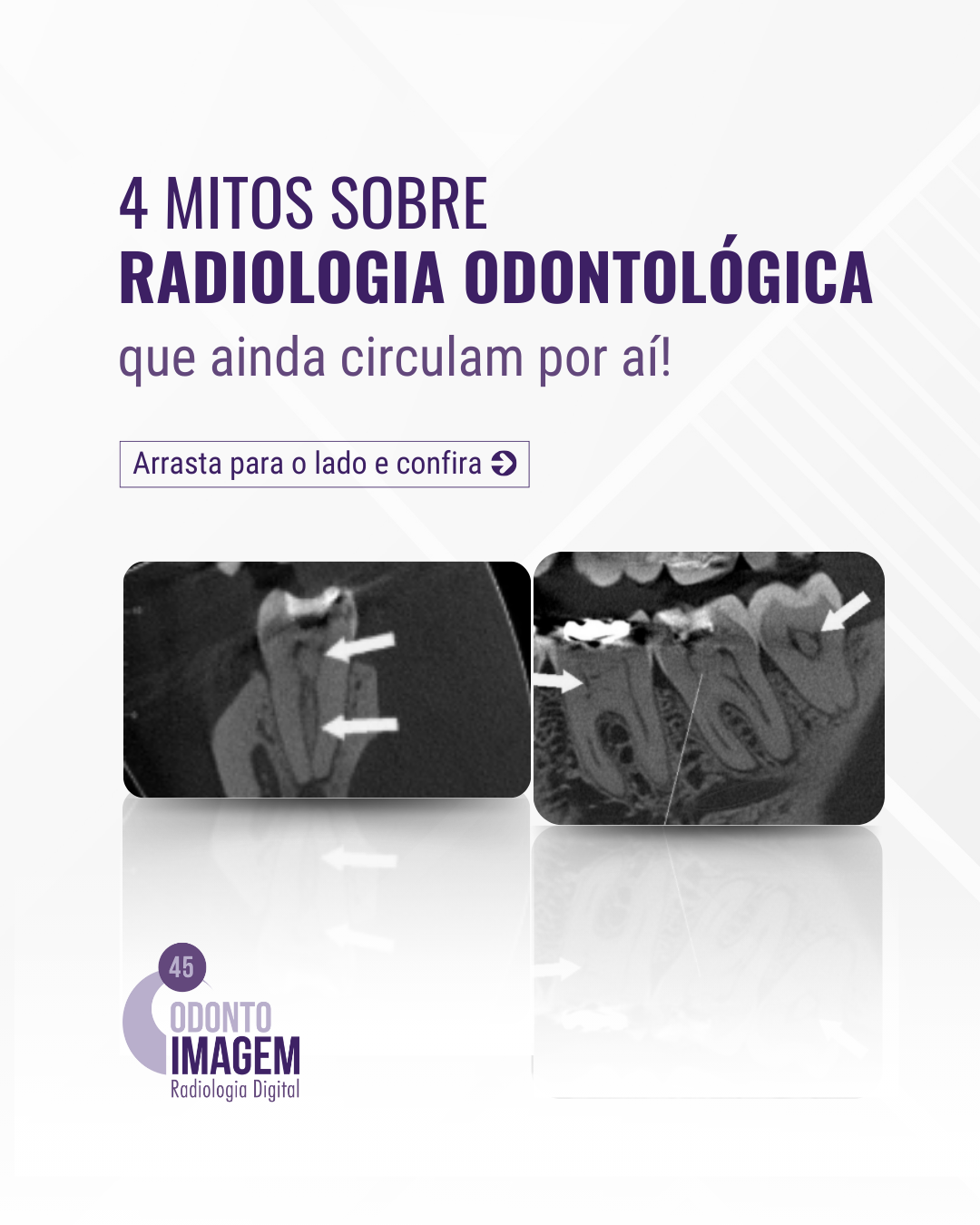 4-mitos-sobre-radiologia-odontologica