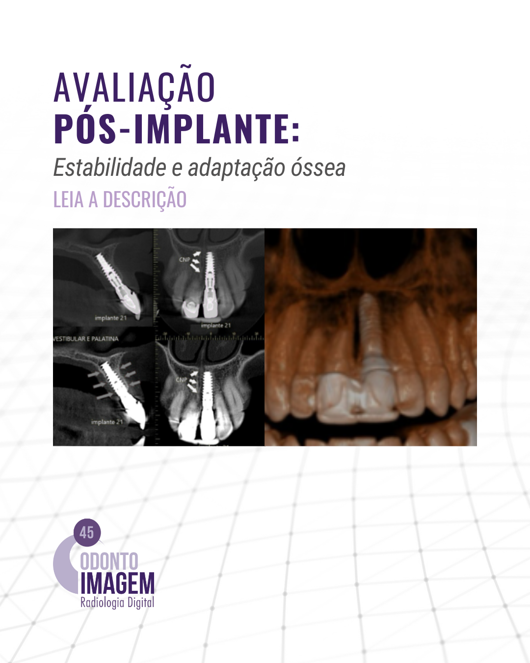 avaliacao-pos-implante